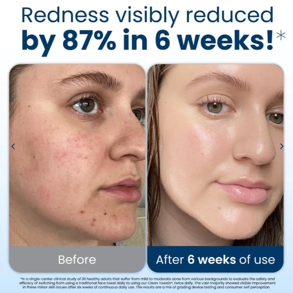 Hygienic Towels for Healthy Skin